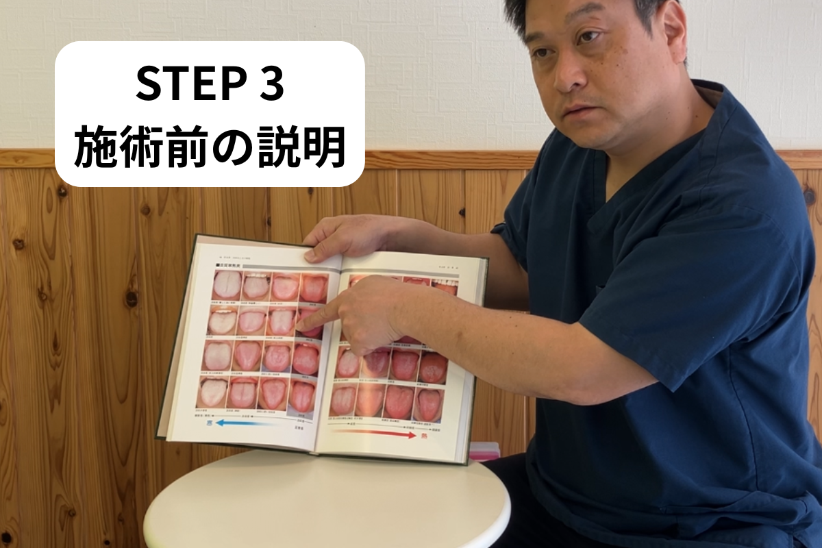 施術前の説明の様子