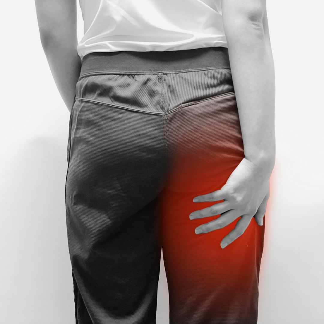 坐骨神経痛で臀部から太ももにかけて痛みを抱える女性のイメージ